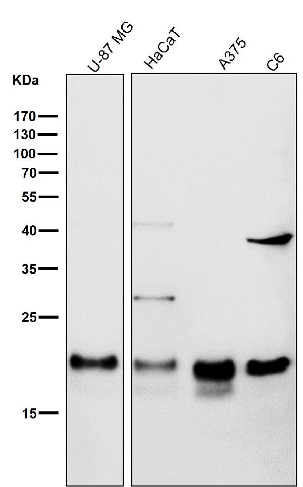 1 - Anti-Ferritin Heavy Chain Rabbit Monoclonal Antibody ABO15220