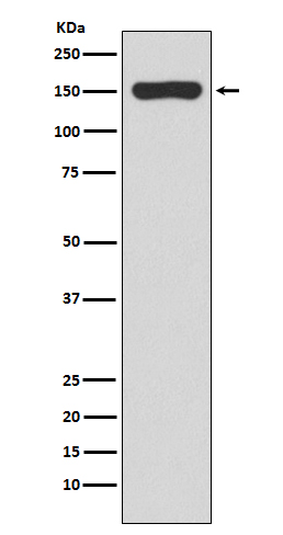 1 - Anti-RNA polymerase beta Rabbit Monoclonal Antibody ABO15221