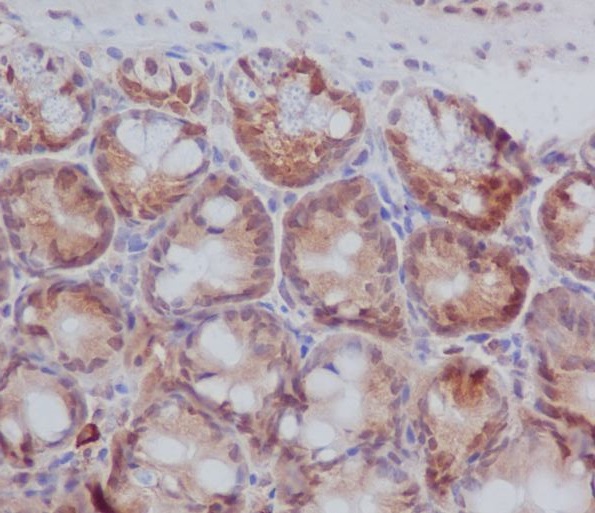 2 - Anti-PKC beta 1 Rabbit Monoclonal Antibody ABO15222