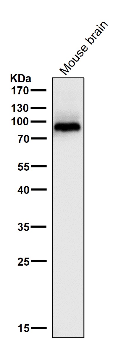 1 - Anti-PKC beta 1 Rabbit Monoclonal Antibody ABO15222