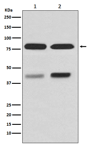1 - Anti-PKC beta 1 Rabbit Monoclonal Antibody ABO15222