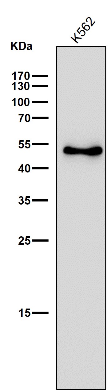 1 - Anti-Ephrin B2 Rabbit Monoclonal Antibody  ABO15223