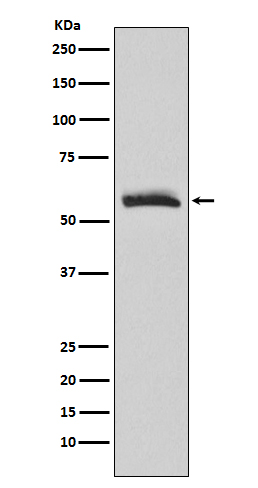 1 - Anti-Muscarinic Acetylcholine Receptor M3 Rabbit Monoclonal Antibody  ABO15224