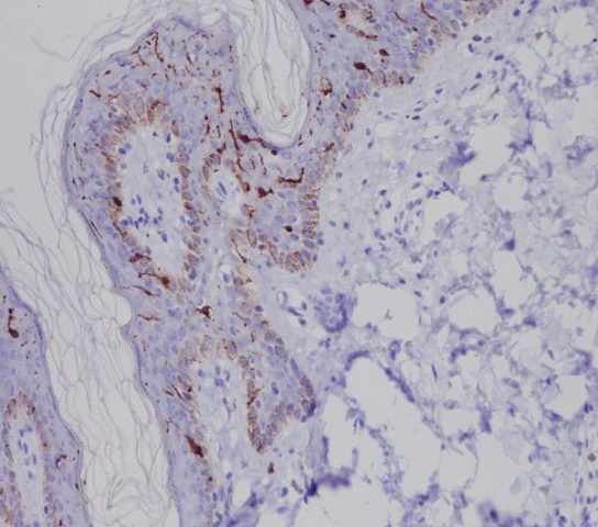 2 - Anti-Langerin (CD207) Rabbit Monoclonal Antibody  ABO15225
