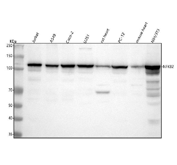 1 - Anti-NFkB p100 / p52 Rabbit Monoclonal Antibody  ABO15227