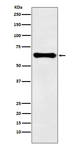 1 - Anti-Factor IX Rabbit Monoclonal Antibody  ABO15229
