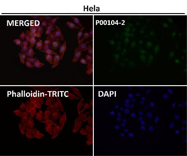 1 - Anti-Phospho-ERK1 (T202) + ERK2 (T185) Rabbit Monoclonal Antibody ABO15230