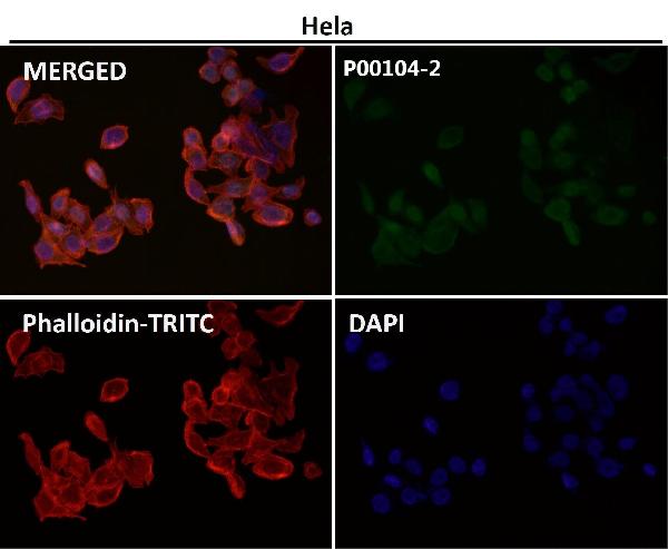 1 - Anti-Phospho-ERK1 (T202) + ERK2 (T185) Rabbit Monoclonal Antibody ABO15230