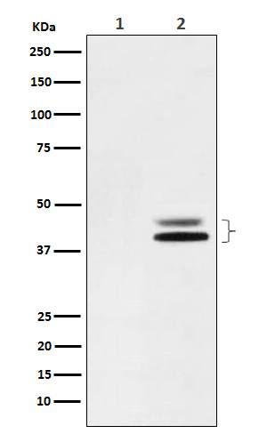 1 - Anti-Phospho-ERK1 (T202) + ERK2 (T185) Rabbit Monoclonal Antibody ABO15230