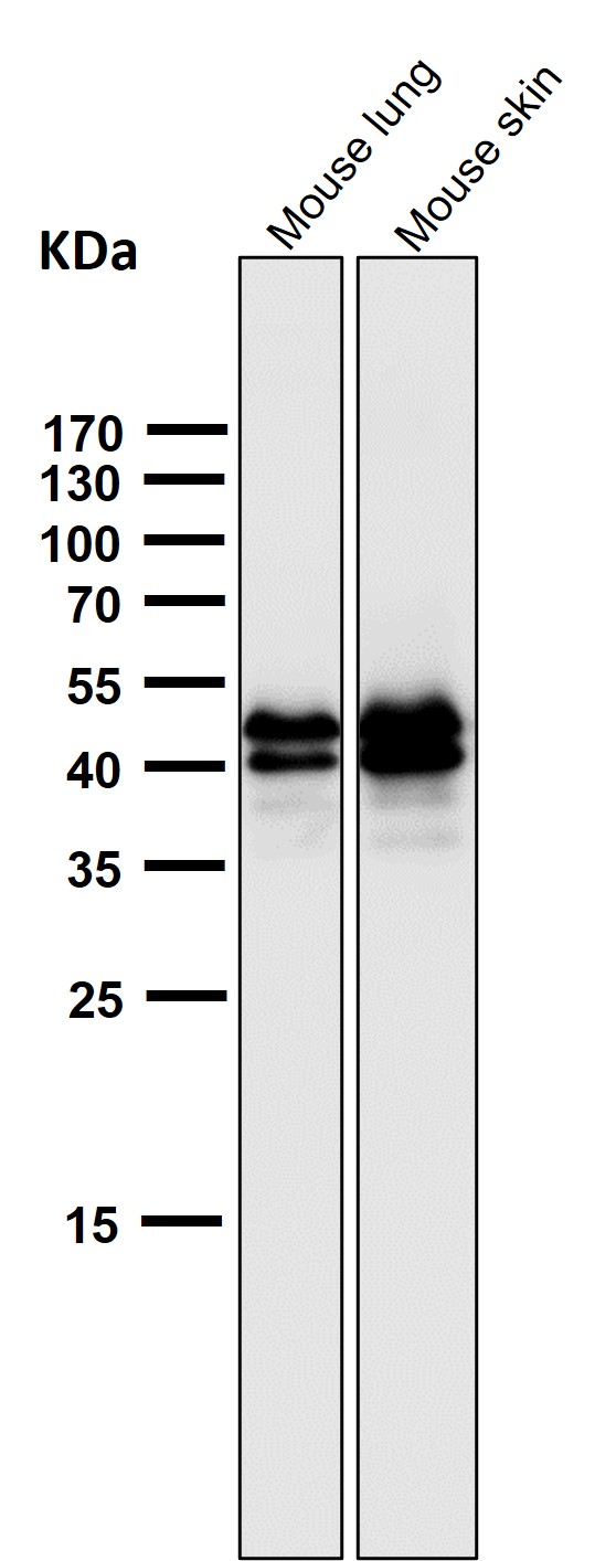 1 - Anti-Phospho-ERK1 (T202) + ERK2 (T185) Rabbit Monoclonal Antibody ABO15230