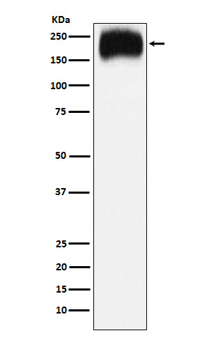 1 - Anti-Niemann Pick C1 Rabbit Monoclonal Antibody ABO15231