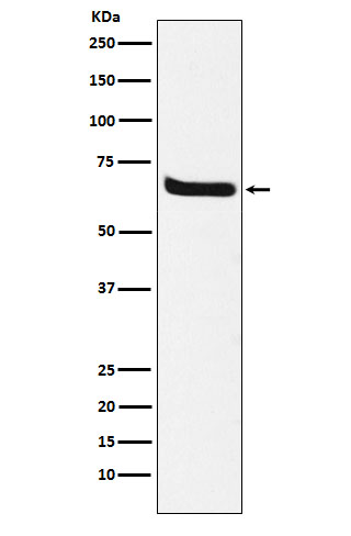 1 - Anti-Klotho Rabbit Monoclonal Antibody ABO15233
