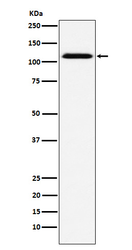 1 - Anti-CD30 Rabbit Monoclonal Antibody ABO15234