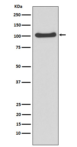1 - Anti-MVP Rabbit Monoclonal Antibody ABO15236