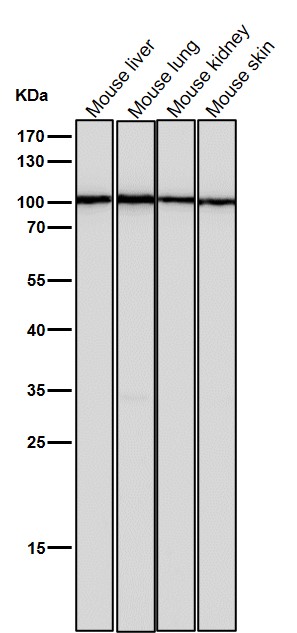 1 - Anti-TPOR Rabbit Monoclonal Antibody ABO15238