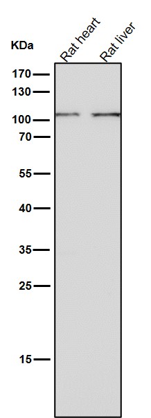 1 - Anti-TPOR Rabbit Monoclonal Antibody ABO15238
