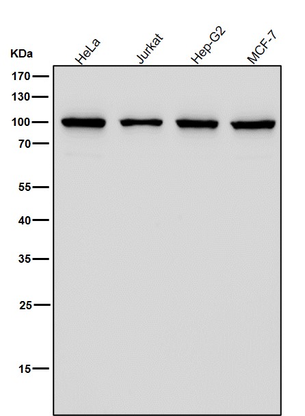 1 - Anti-TPOR Rabbit Monoclonal Antibody ABO15238