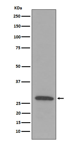 1 - Anti-C1QB Rabbit Monoclonal Antibody ABO15239