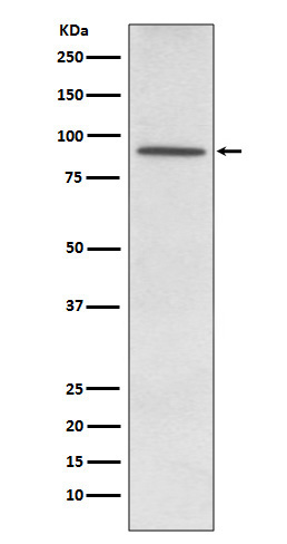 1 - Anti-PDE4D Rabbit Monoclonal Antibody ABO15240