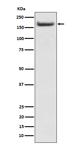 1 - Anti-IRS2 Rabbit Monoclonal Antibody ABO15242