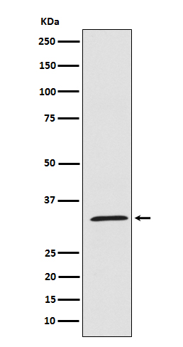 1 - Anti-UCP1+UCP3 Rabbit Monoclonal Antibody ABO15243