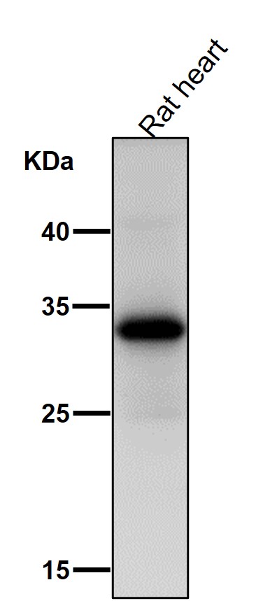 1 - Anti-UCP1+UCP3 Rabbit Monoclonal Antibody ABO15243