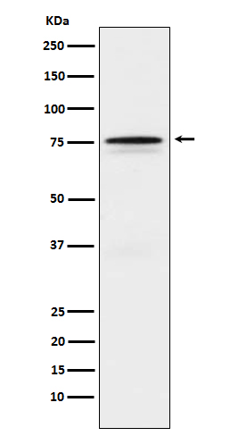 1 - Anti-FOXO1 Rabbit Monoclonal Antibody ABO15244