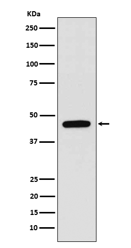 1 - Anti-WIPI1 Rabbit Monoclonal Antibody ABO15245