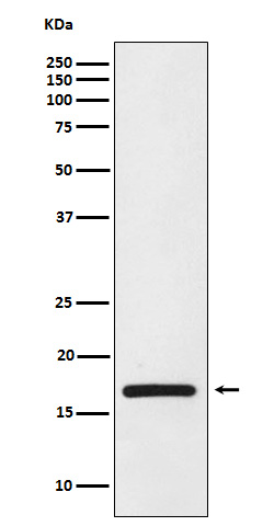 1 - Anti-HMGA1 Rabbit Monoclonal Antibody ABO15247