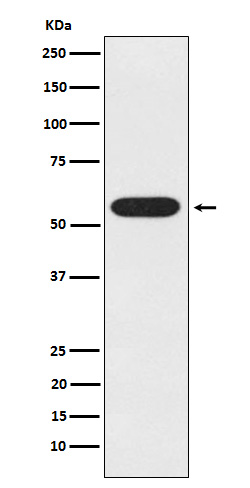 1 - Anti-UAP1 Rabbit Monoclonal Antibody ABO15249