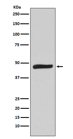 1 - Anti-MAPKAP Kinase 2 Rabbit Monoclonal Antibody ABO15251
