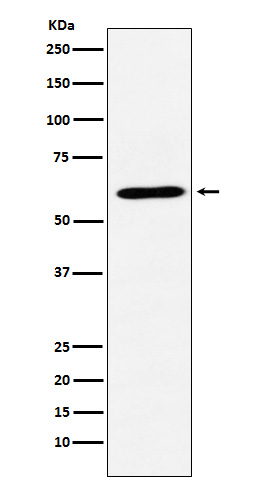 1 - Anti-CRMP1 Rabbit Monoclonal Antibody ABO15253