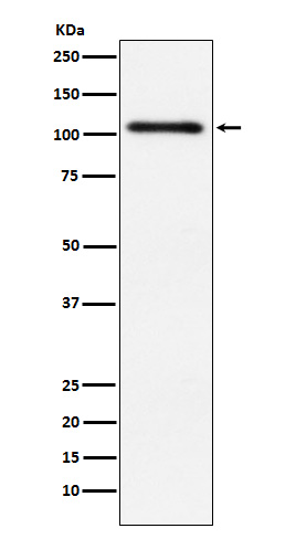 1 - Anti-Protein Kinase D2 Rabbit Monoclonal Antibody ABO15254