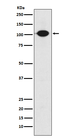 1 - Anti-GABA B Receptor 2 Rabbit Monoclonal Antibody ABO15256
