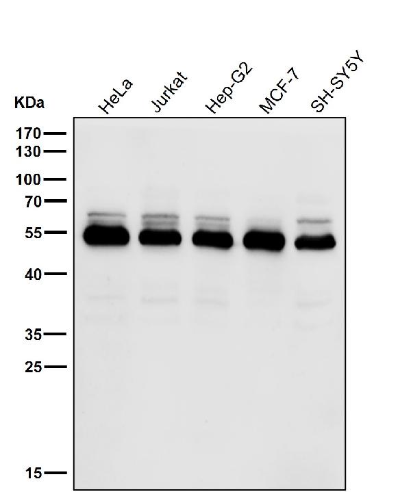 1 - Anti-HSC70 Interacting Protein HIP Rabbit Monoclonal Antibody ABO15258