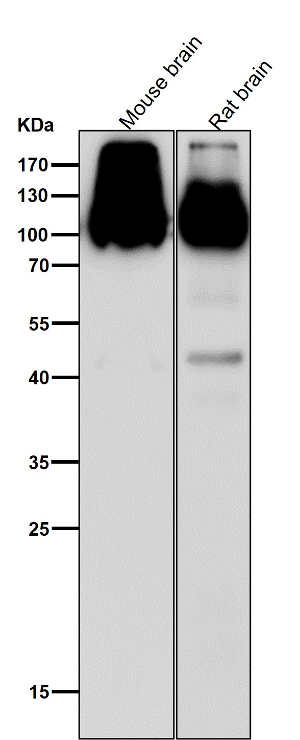 1 - Anti-GluR2+GluR3 Rabbit Monoclonal Antibody ABO15260