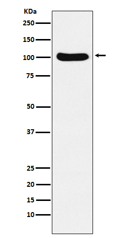 1 - Anti-Exportin2 Rabbit Monoclonal Antibody ABO15262
