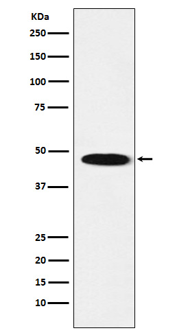 1 - Anti-GABA A Receptor beta 1 Rabbit Monoclonal Antibody ABO15263
