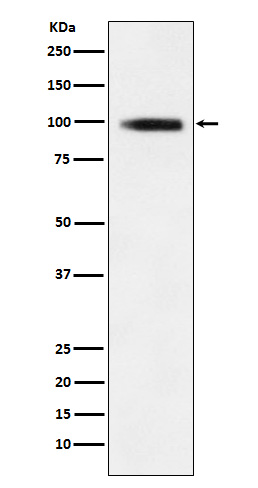 1 - Anti-GIT1 Rabbit Monoclonal Antibody ABO15264