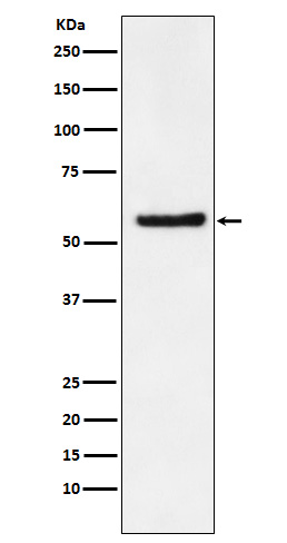 1 - Anti-DKC1 Rabbit Monoclonal Antibody ABO15266