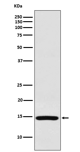 1 - Anti-RPS19 Rabbit Monoclonal Antibody ABO15267