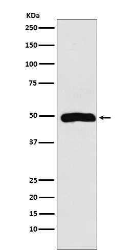 1 - Anti-Arp3 Rabbit Monoclonal Antibody ABO15268