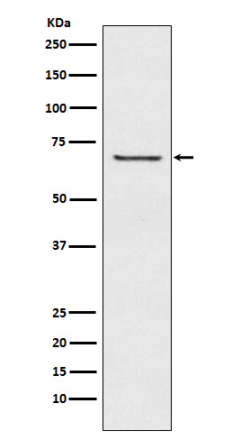 1 - Anti-GABA A Receptor beta 2 Rabbit Monoclonal Antibody ABO15269