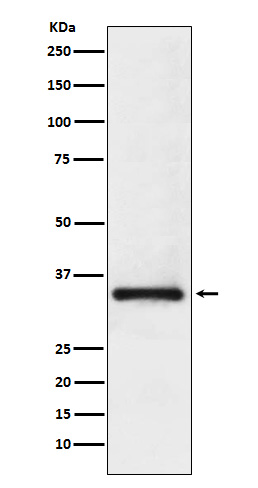 1 - Anti-U1A Rabbit Monoclonal Antibody ABO15270