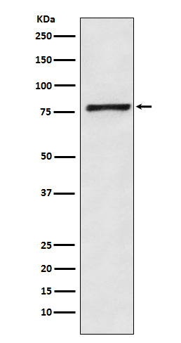 1 - Anti-Fructose 6 Phosphate Kinase Rabbit Monoclonal Antibody ABO15273