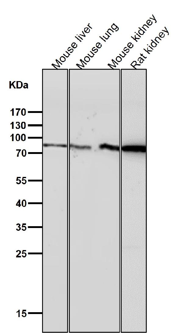 1 - Anti-Fructose 6 Phosphate Kinase Rabbit Monoclonal Antibody ABO15273