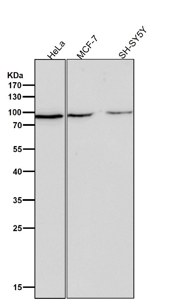 1 - Anti-Fructose 6 Phosphate Kinase Rabbit Monoclonal Antibody ABO15273