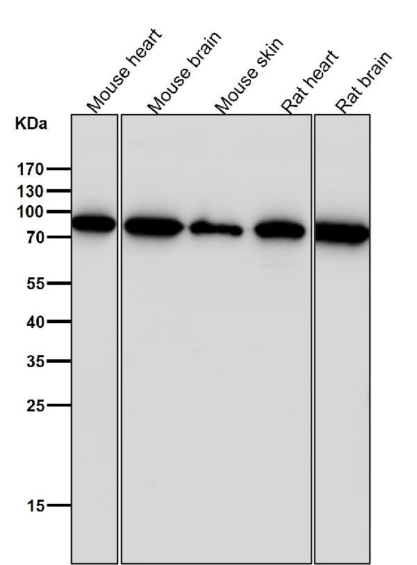 1 - Anti-Fructose 6 Phosphate Kinase Rabbit Monoclonal Antibody ABO15273
