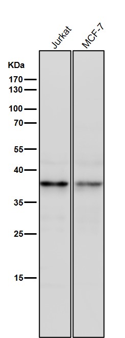 1 - Anti-CD83 Rabbit Monoclonal Antibody ABO15276