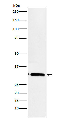1 - Anti-EB3 Rabbit Monoclonal Antibody ABO15280